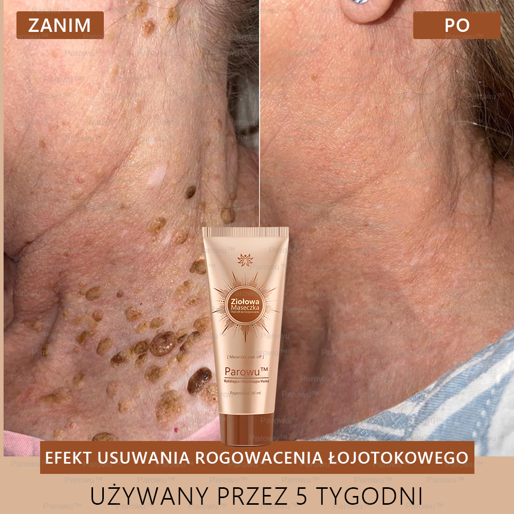 ✨🌙Parowu™ Wybielająca i Rozjaśniająca Maska - Naturalne składniki trwale usuwają plamy, piegi i przebarwienia