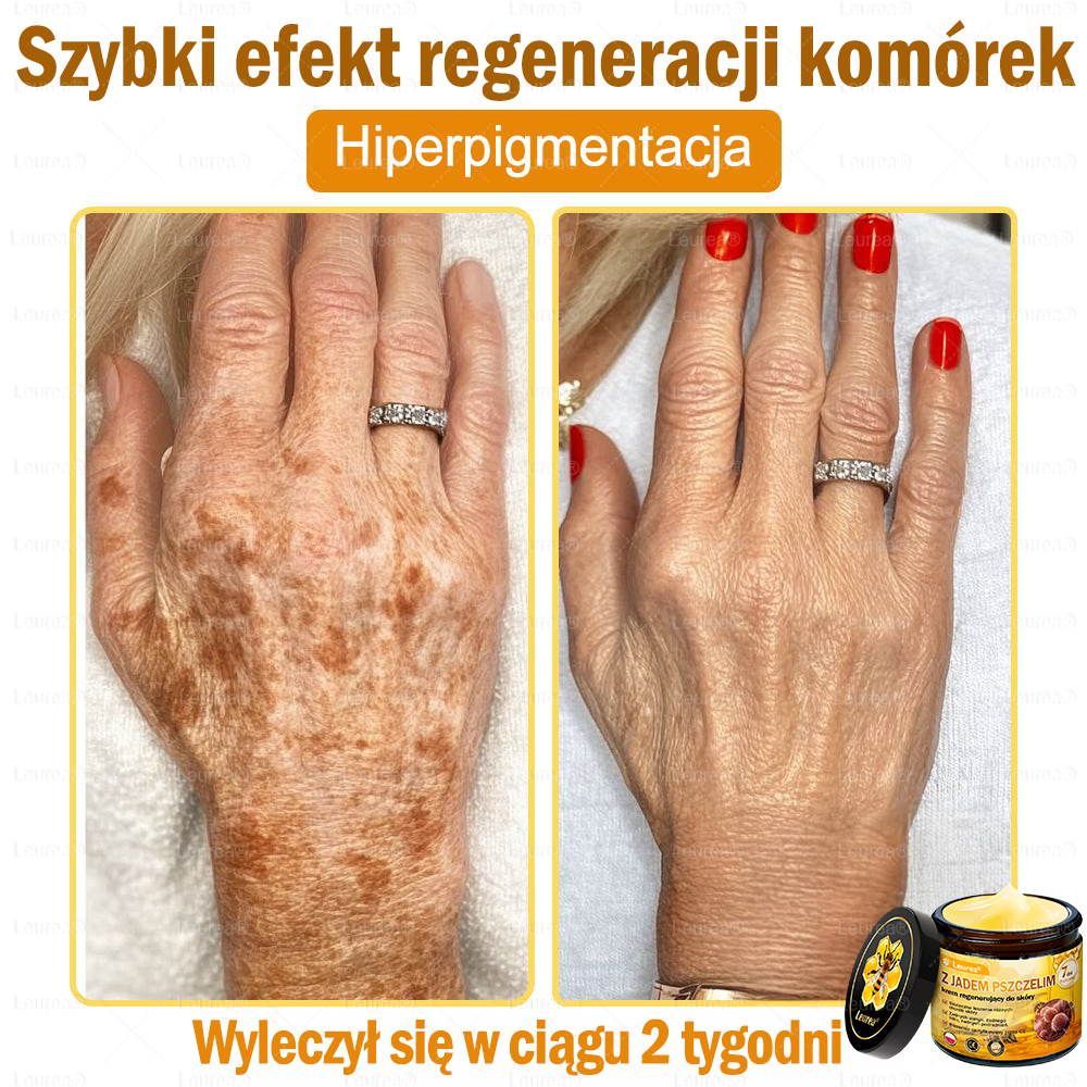 ✨✨✨✨Leurea® Krem Regenerujący z Jadem Pszczelim🔥 Naturalna regeneracja skóry, wygładzenie zmarszczek i promienna cera-50 ml
