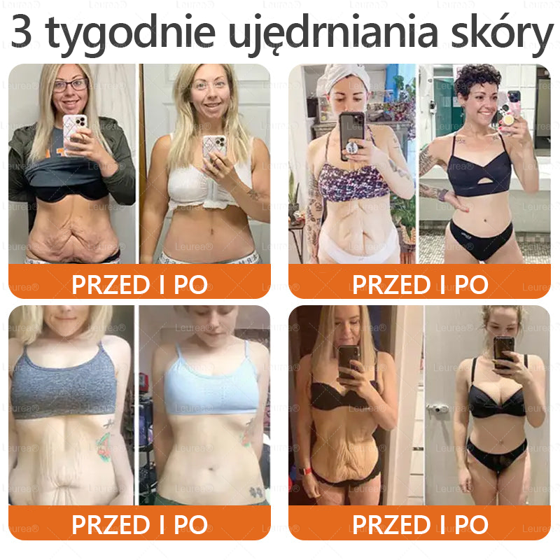 🔥Leurea® Krem z Jadem Pszczelim 🔥 Regeneracja skóry, redukcja zmarszczek i promienny wygląd – 50 ml