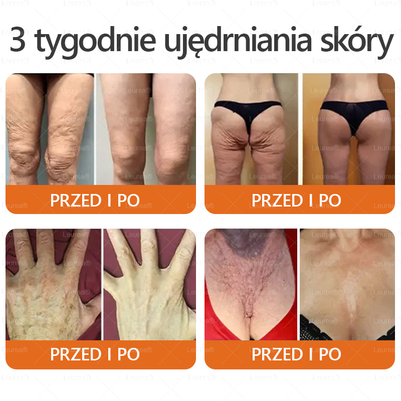 🔥Leurea® Krem z Jadem Pszczelim 🔥 Regeneracja skóry, redukcja zmarszczek i promienny wygląd – 50 ml