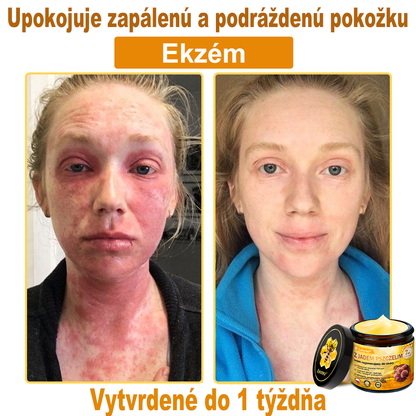 🔥Leurea® Krem z Jadem Pszczelim 🔥 Regeneracja skóry, redukcja zmarszczek i promienny wygląd – 50 ml