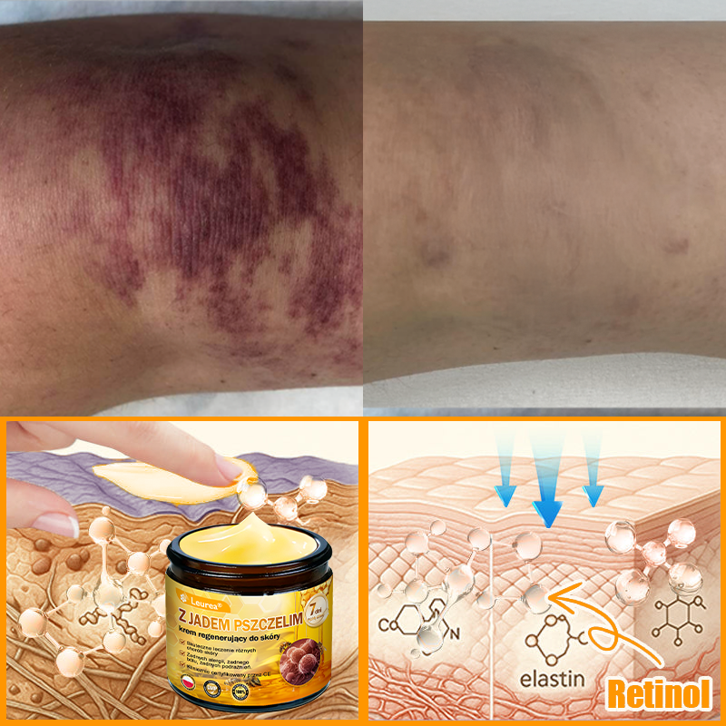 🔥Leurea® Krem z Jadem Pszczelim 🔥 Regeneracja skóry, redukcja zmarszczek i promienny wygląd – 50 ml