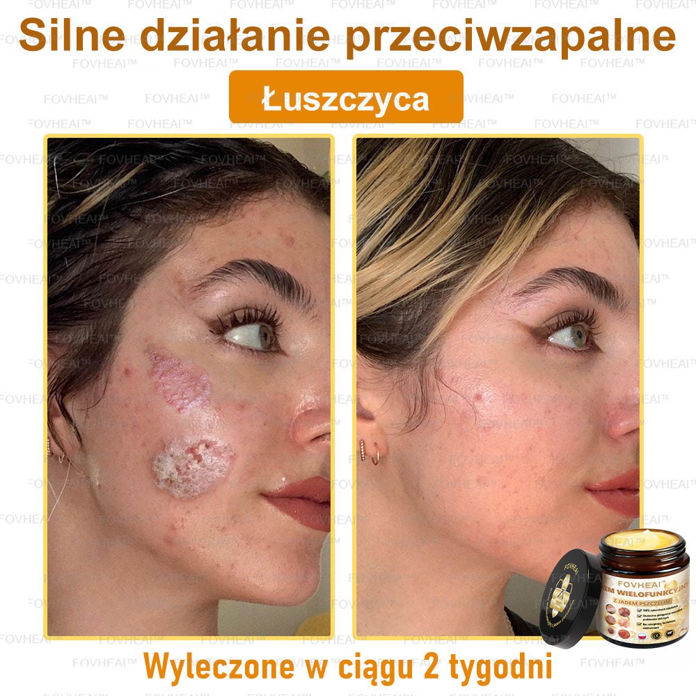 🐝FOVHEAl™ Krem wielofunkcyjny z jadem pszczelim - Polecane przez dermatologów – Odpowiednie dla każdego wieku