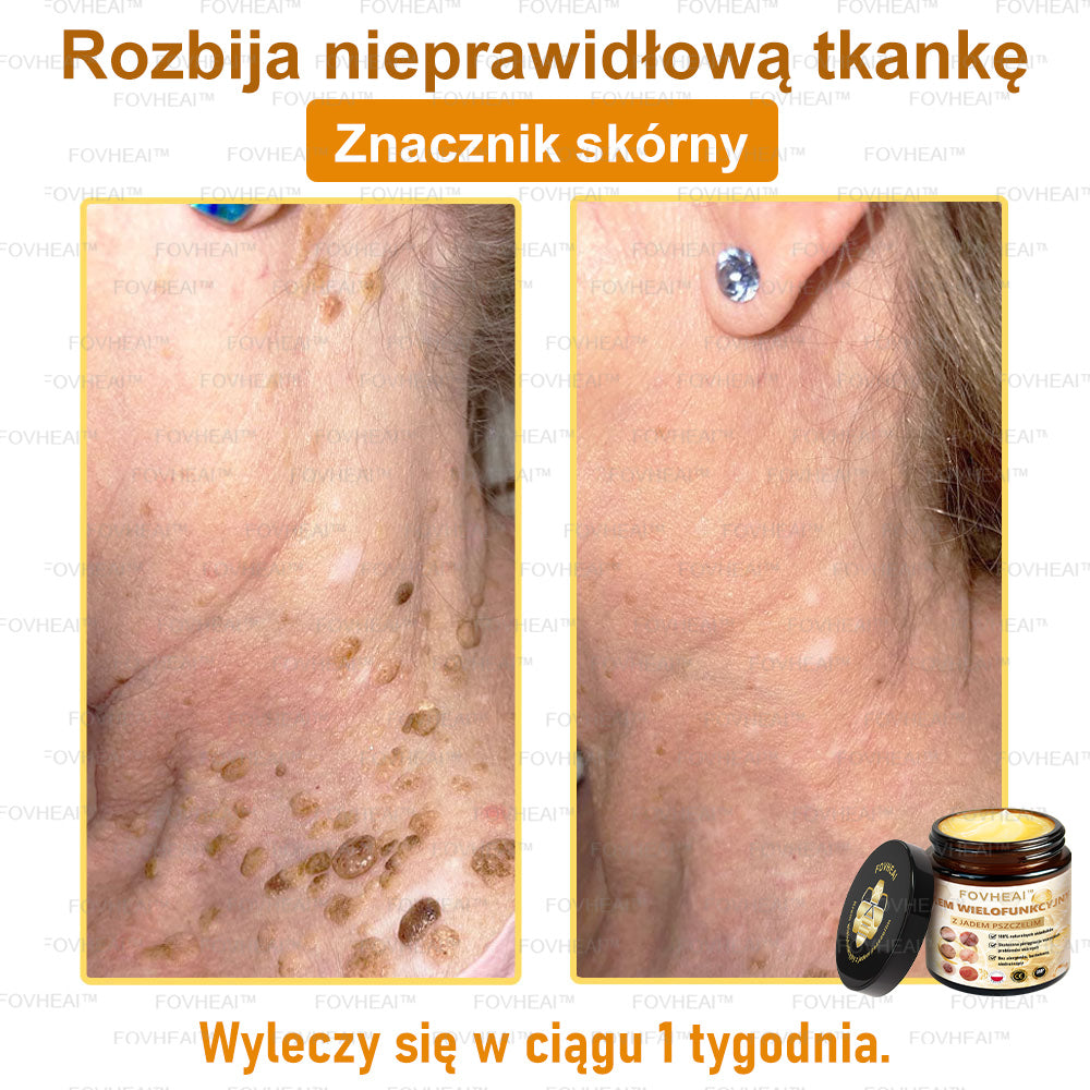 🐝FOVHEAl™ Krem wielofunkcyjny z jadem pszczelim - Polecane przez dermatologów – Odpowiednie dla każdego wieku