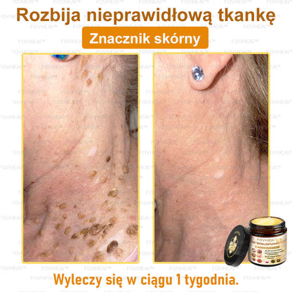 🐝FOVHEAl™ Krem wielofunkcyjny z jadem pszczelim - Polecane przez dermatologów – Odpowiednie dla każdego wieku
