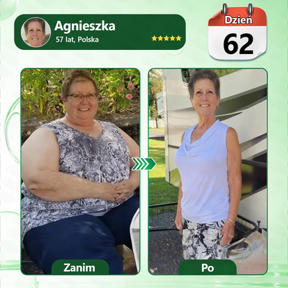 🍀🍀🍀🍀Polska oficjalny sklep | Kkio® Moringa·Berberyna × NAD+ 10 w 1 nano mikroigłowy plaster – codzienne stosowanie, widoczne efekty w ciągu 7 dni ✅ na wagę ciała, skórę, cukrzycę i zdrowie stawów 🗽