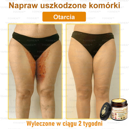 🐝FOVHEAl™ Krem wielofunkcyjny z jadem pszczelim - Polecane przez dermatologów – Odpowiednie dla każdego wieku