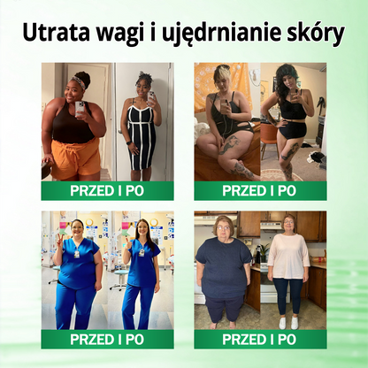 🍀🍀🍀🍀Polska oficjalny sklep | Kkio® Moringa·Berberyna × NAD+ 10 w 1 nano mikroigłowy plaster – codzienne stosowanie, widoczne efekty w ciągu 7 dni ✅ na wagę ciała, skórę, cukrzycę i zdrowie stawów 🗽