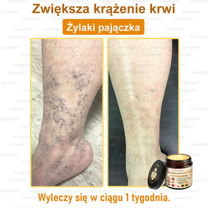 🐝FOVHEAl™ Krem wielofunkcyjny z jadem pszczelim - Polecane przez dermatologów – Odpowiednie dla każdego wieku