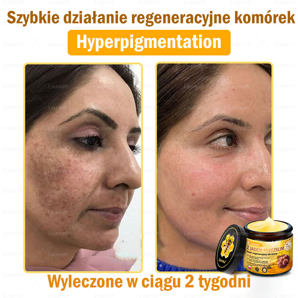 🔥Leurea® Krem z Jadem Pszczelim 🔥 Regeneracja skóry, redukcja zmarszczek i promienny wygląd – 50 ml