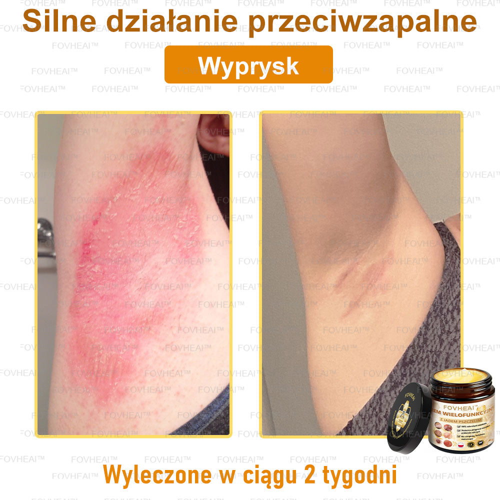 🐝FOVHEAl™ Krem wielofunkcyjny z jadem pszczelim - Polecane przez dermatologów – Odpowiednie dla każdego wieku