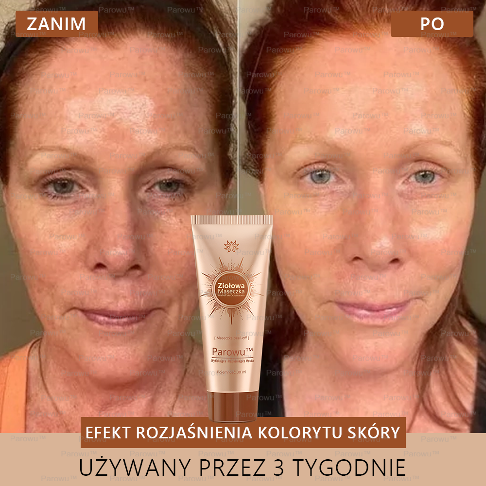 ✨🌙Parowu™ Wybielająca i Rozjaśniająca Maska - Naturalne składniki trwale usuwają plamy, piegi i przebarwienia
