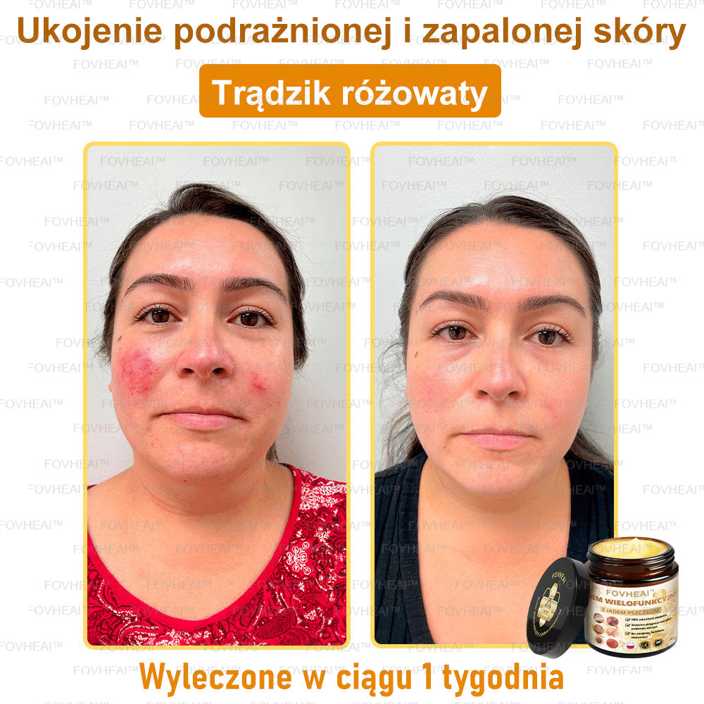 🐝FOVHEAl™ Krem wielofunkcyjny z jadem pszczelim - Polecane przez dermatologów – Odpowiednie dla każdego wieku