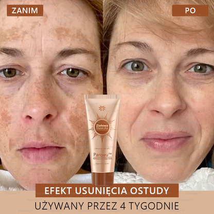 ✨🌙Parowu™ Wybielająca i Rozjaśniająca Maska - Naturalne składniki trwale usuwają plamy, piegi i przebarwienia