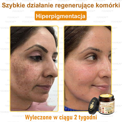 🐝FOVHEAl™ Krem wielofunkcyjny z jadem pszczelim - Polecane przez dermatologów – Odpowiednie dla każdego wieku