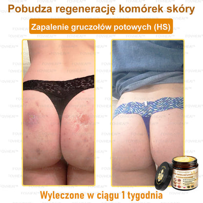 🐝FOVHEAl™ Krem wielofunkcyjny z jadem pszczelim - Polecane przez dermatologów – Odpowiednie dla każdego wieku